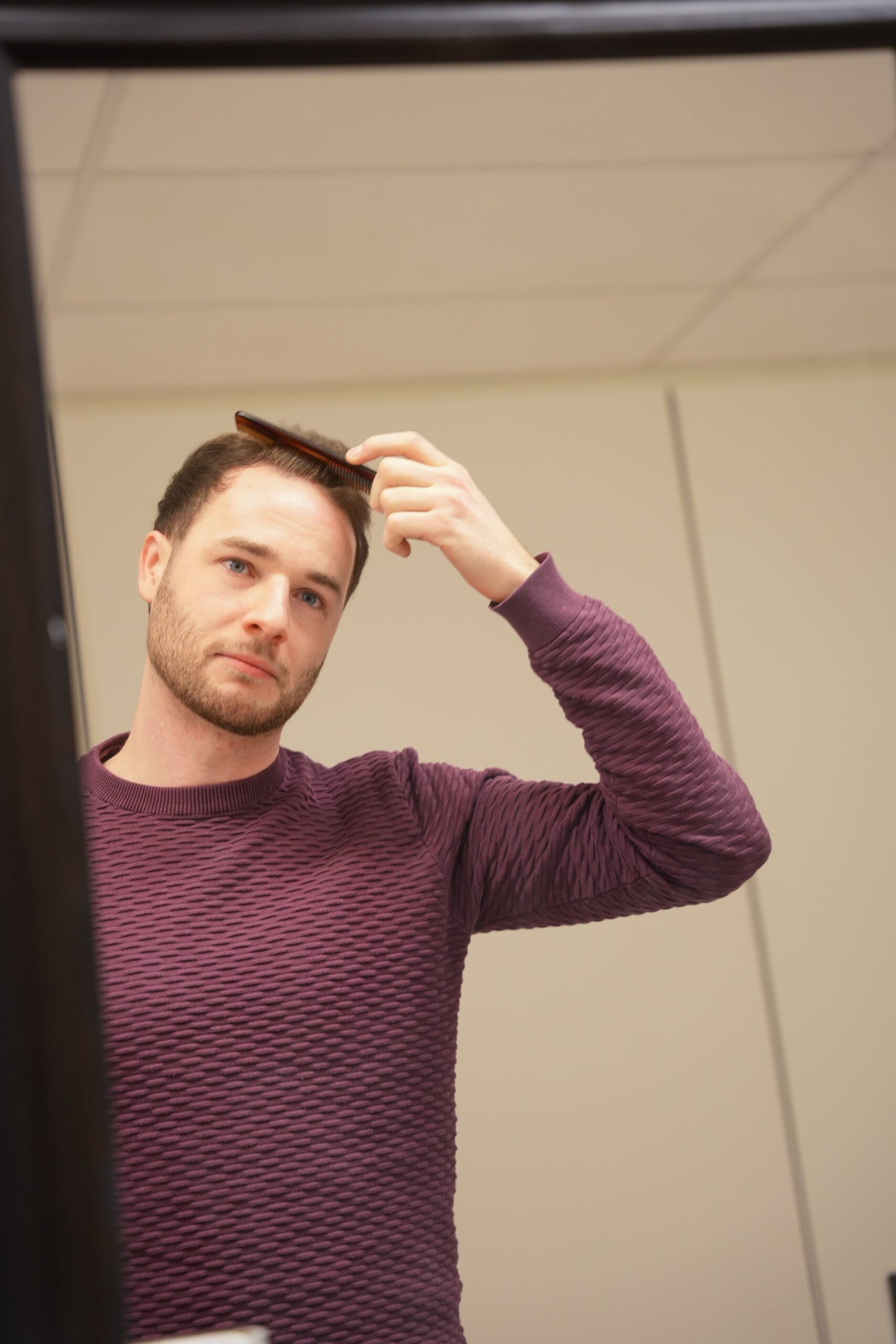 Haargroei stimuleren na een haartransplantatie